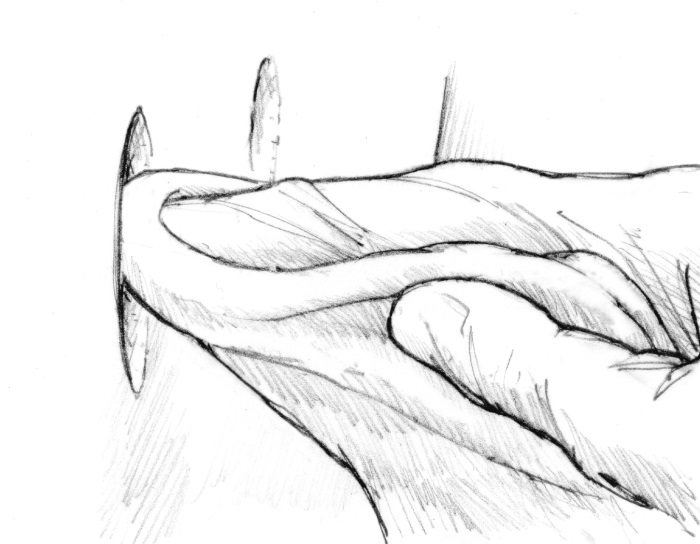 Wipe the blister cavity clean with an alcohol prep pad.